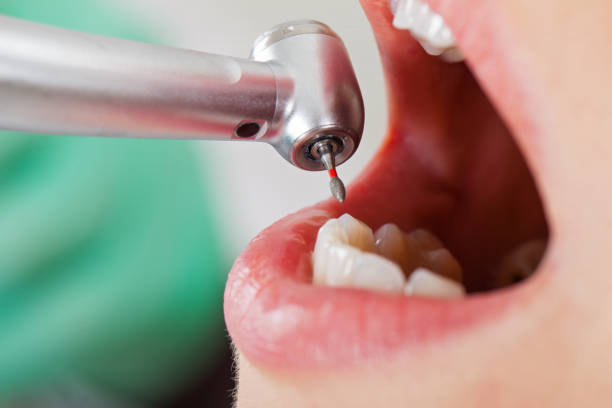 Best Emergency Denture Repair in New Buffalo, MI